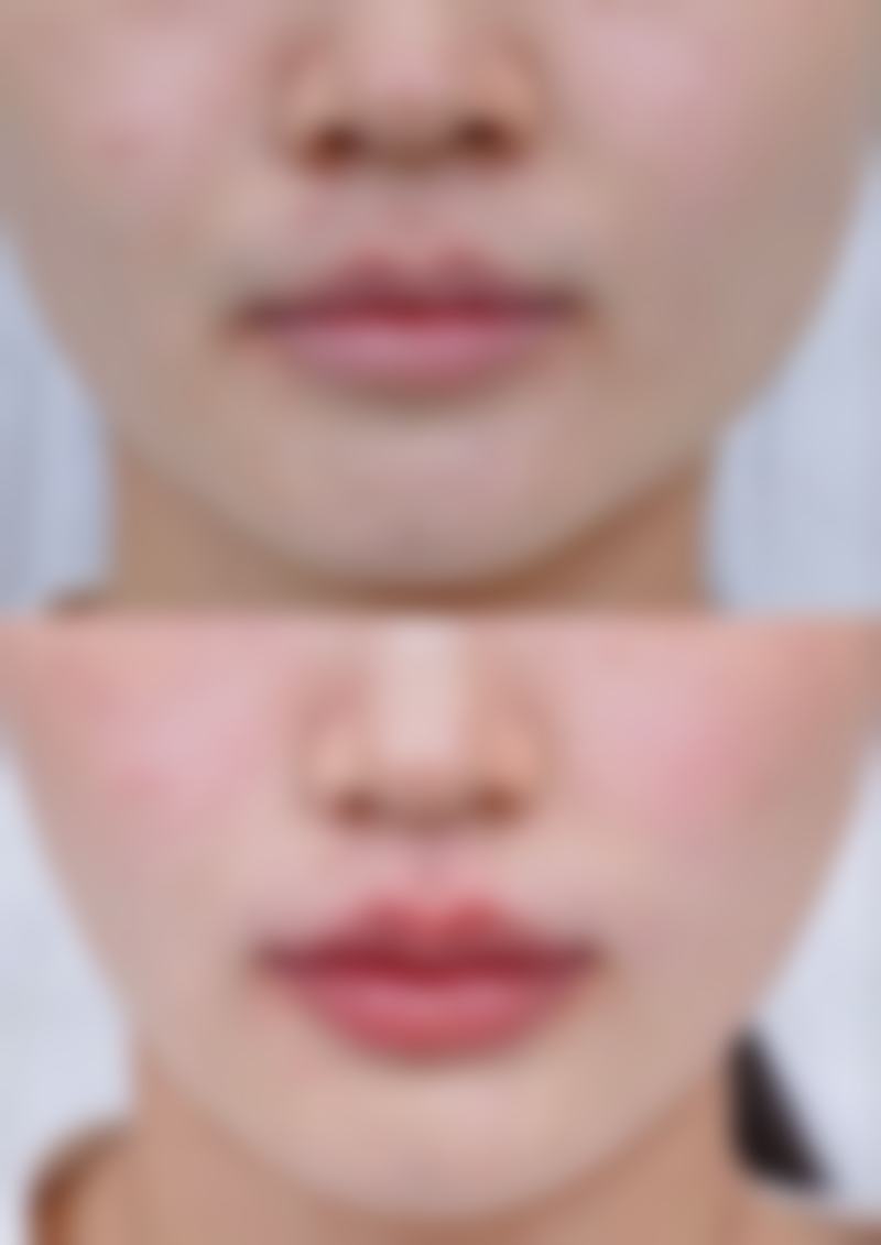 何燕医生技术优势