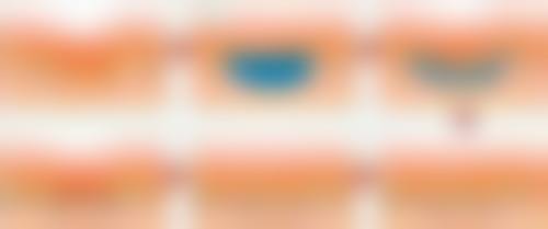 王桂龙医生项目收费价格