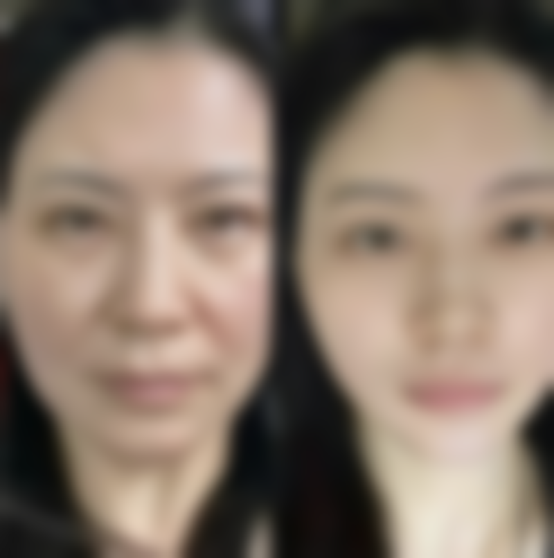 刘崇林医生项目收费价格