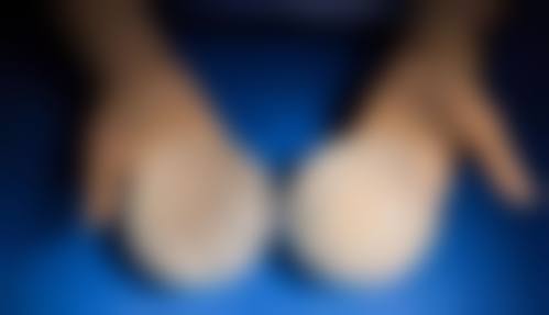 董立鹏医生技术优势