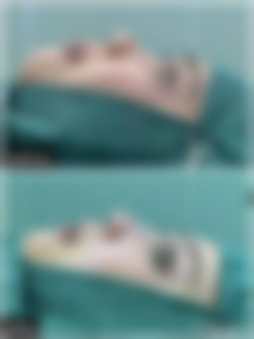 符恒医生技术优势