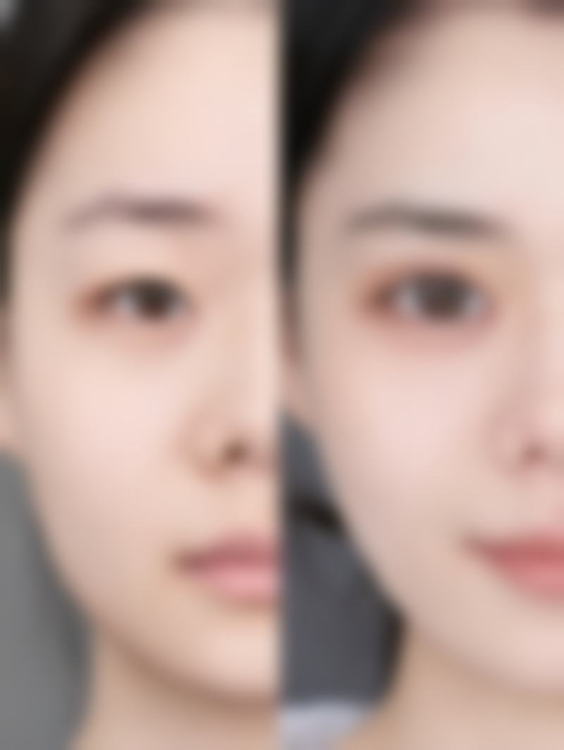 长沙美亦整形医院收费价格表