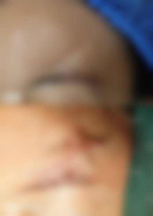 刘敏医生项目收费价格