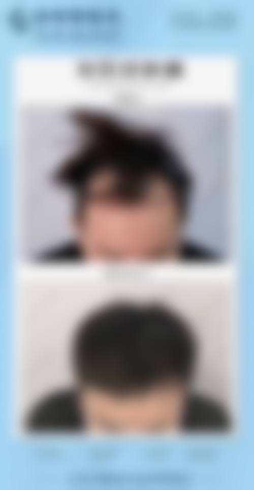 北京海医诚美医疗美容门诊部收费价格表