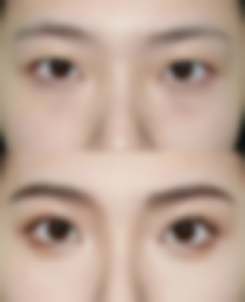 伊宁禾颜美整形医院收费价格表