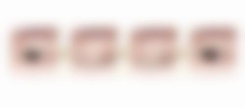 付炳根医生技术优势