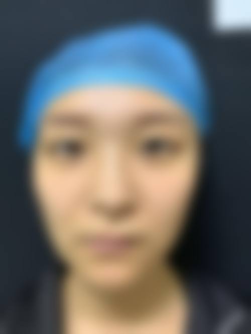 付炳根医生项目收费价格