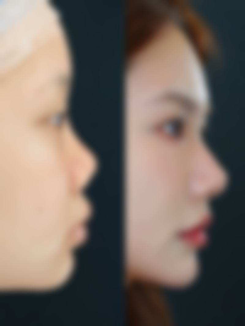 内蒙古呼伦贝尔希雅整形医院预约挂号方式