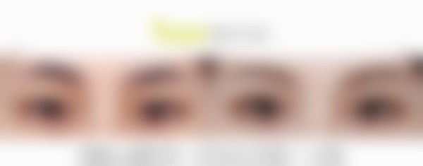 韩国1mm整形外科医院特色诊疗项目与技术优势