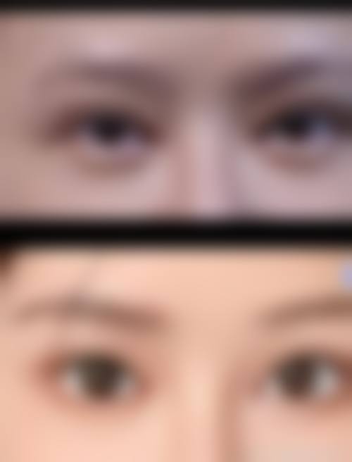 梁胜文医生项目收费价格