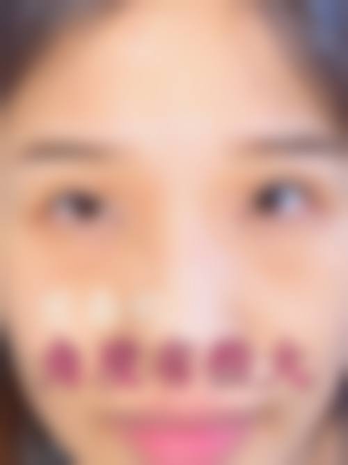 梁胜文医生技术优势