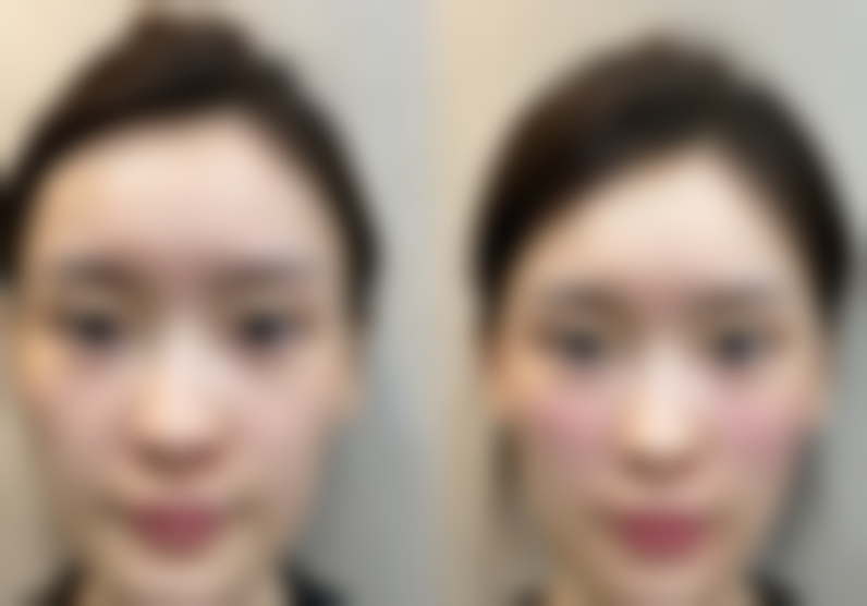 安庆增美医疗美容门诊预约挂号方式