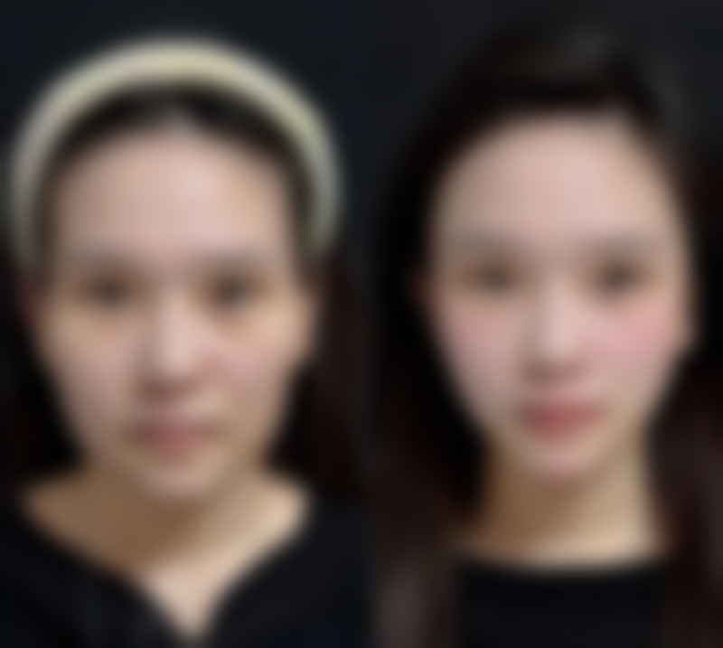 韩国美尔韩整形医院预约挂号方式