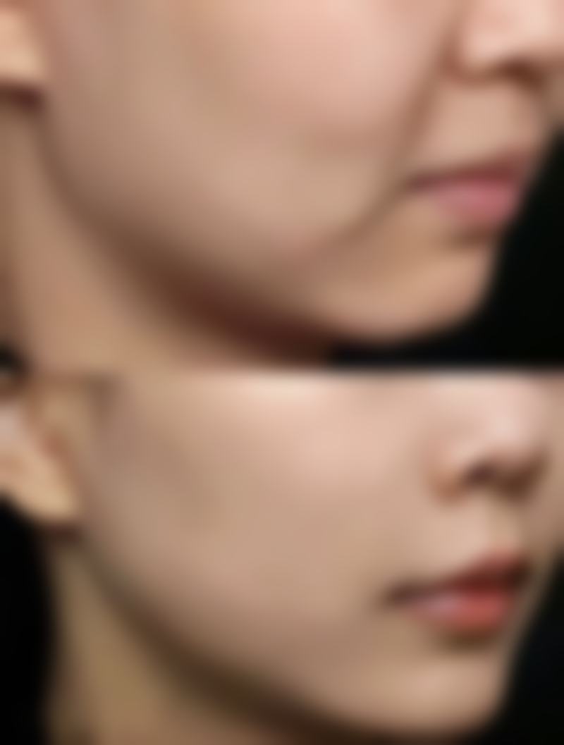 上海伊美尔港华整形医院预约挂号方式