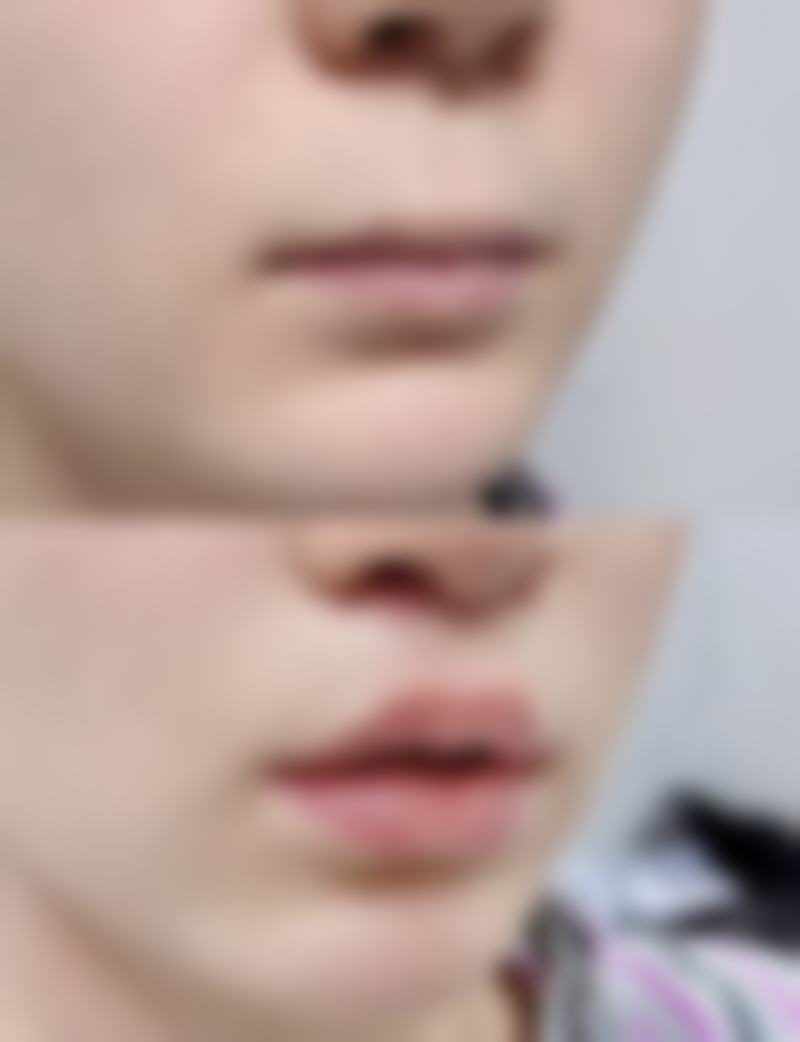 刘志忠医生预约挂号