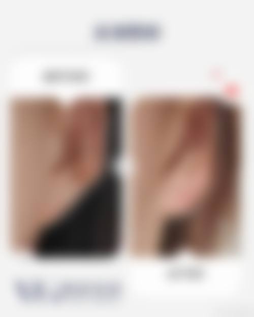 长沙谢正辉医疗美容门诊部收费价格表