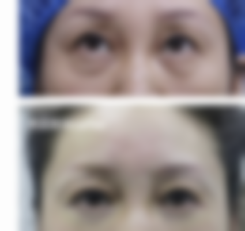 郑宰永医生技术优势