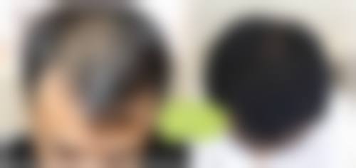 江苏南通科禾植发医生团队介绍