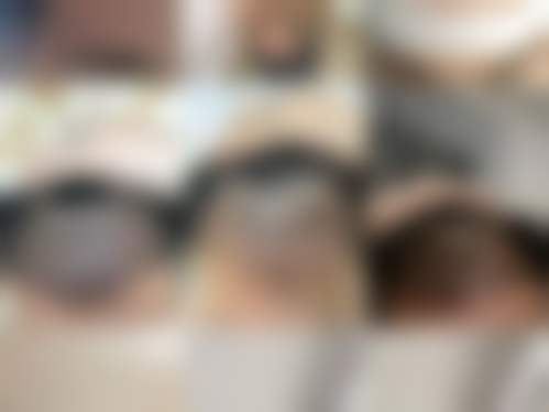 江苏南通科禾植发收费价格表