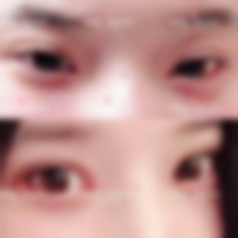 李丙玟医生项目收费价格