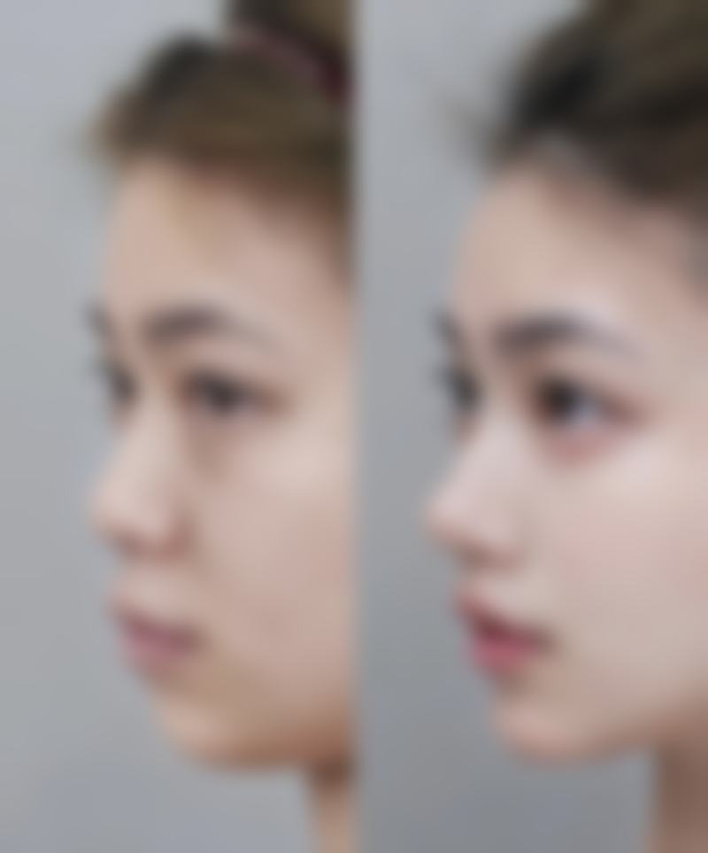 广州奢媛医疗美容医院特色诊疗项目与技术优势