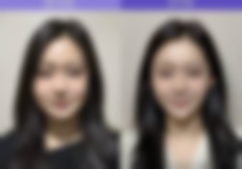 吉林长春蓝鑫医疗美容门诊部收费价格表