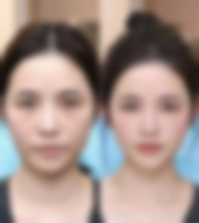 广西 南宁莉薇豪美整形医院特色诊疗项目与技术优势