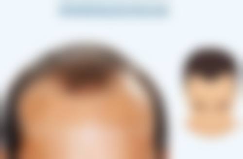 张宇恒医生预约挂号