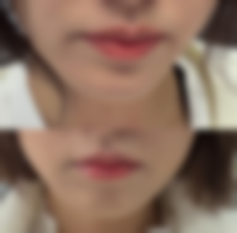 朝阳伊美医疗美容诊所收费价格表