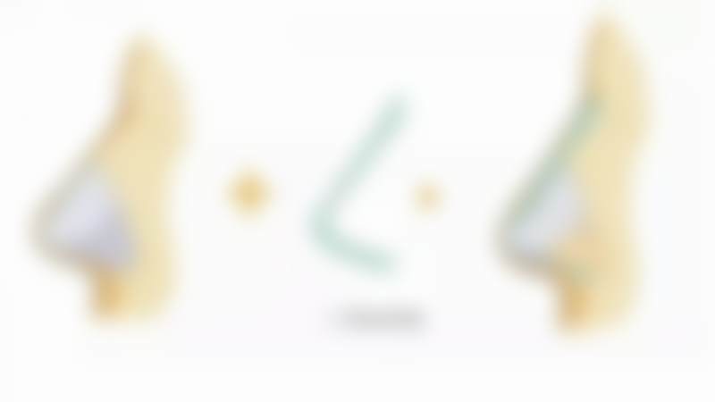 胡立医生项目收费价格