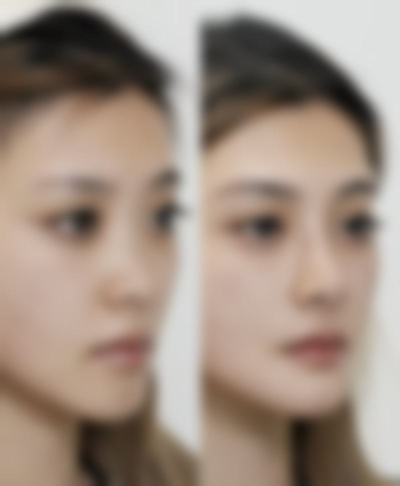 北京美尔加整形医院预约挂号方式