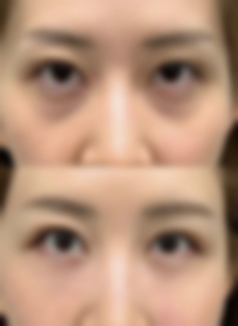 贾优优医生项目收费价格