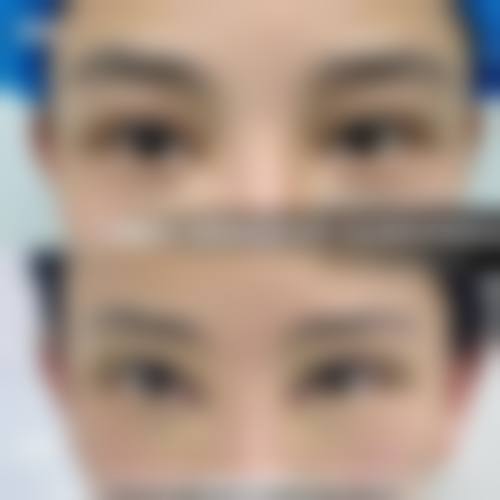 哈密阳光整形美容医院收费价格表