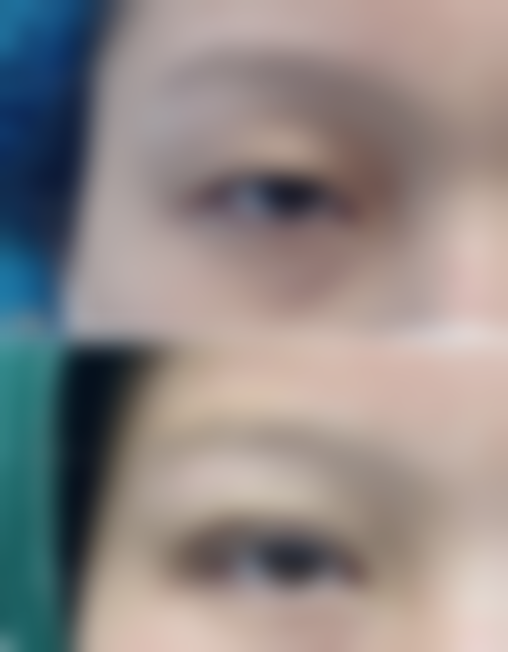 青岛华韩整形医院预约挂号方式