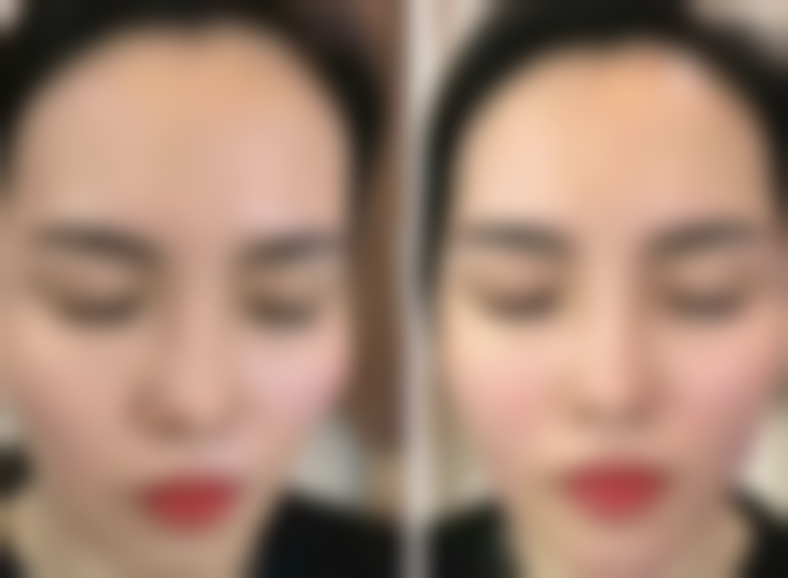 朱宁文医生预约挂号