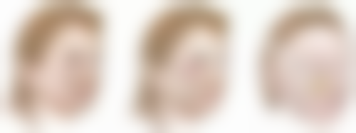 洪丽医生技术优势