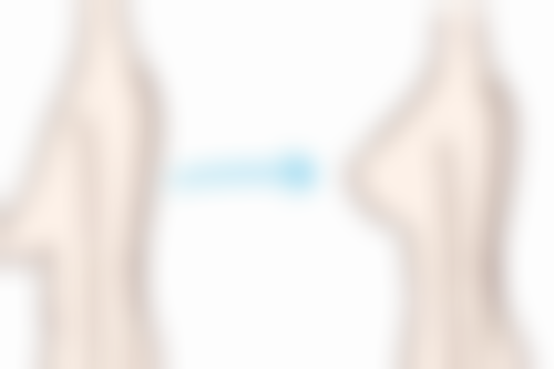 中南大学湘雅二医院何燕医生技术优势