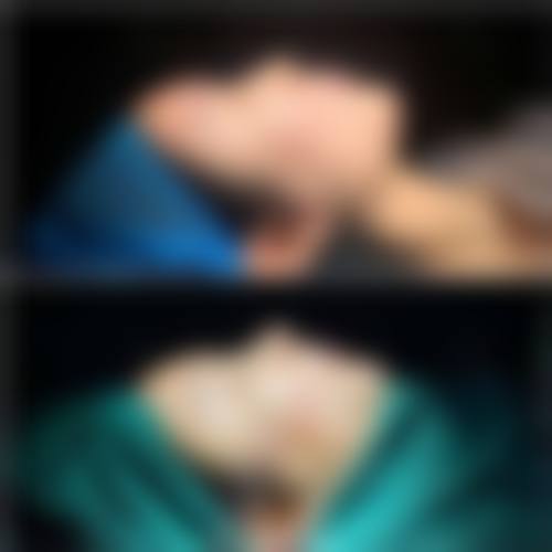 李周映医生技术优势