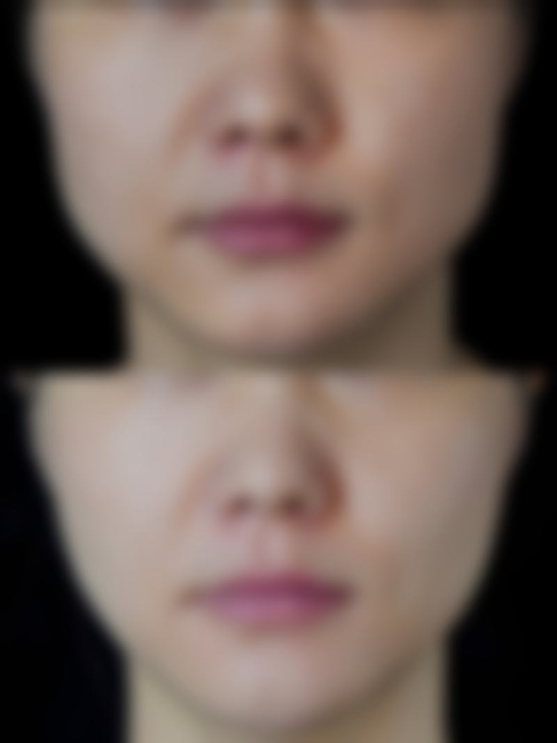 达州市海博医疗美容诊所收费价格表