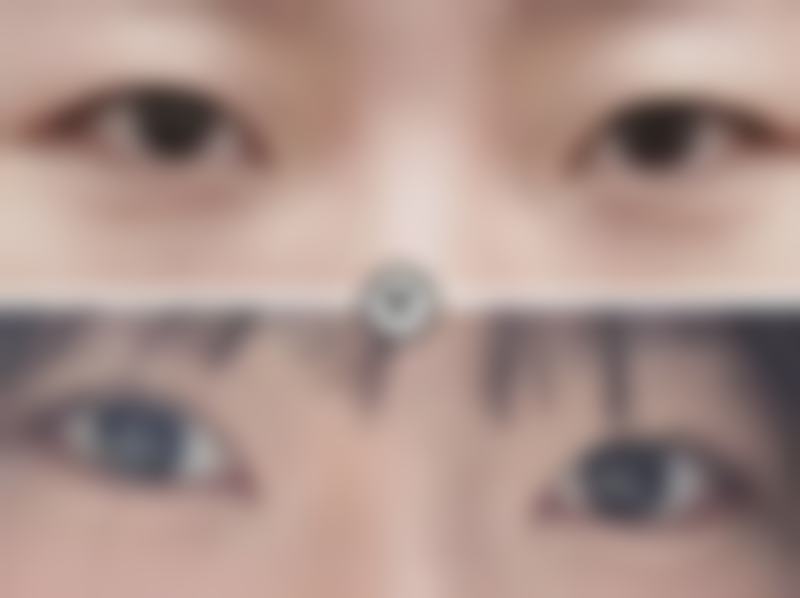 包头乔兮予时整形收费价格表