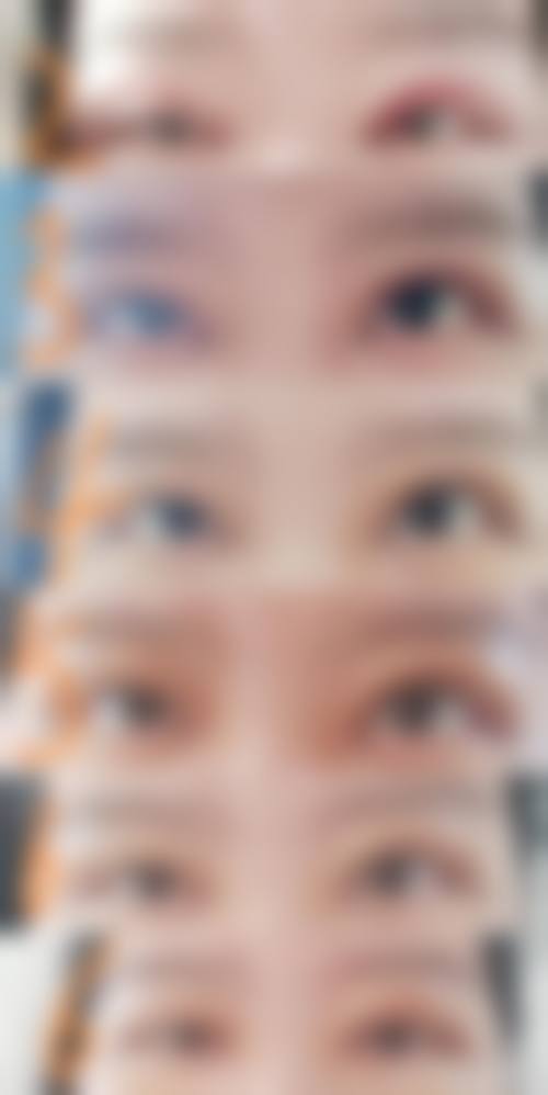 付炳根医生项目收费价格