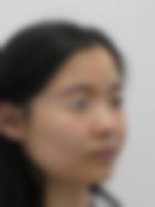 周立意医生项目收费价格