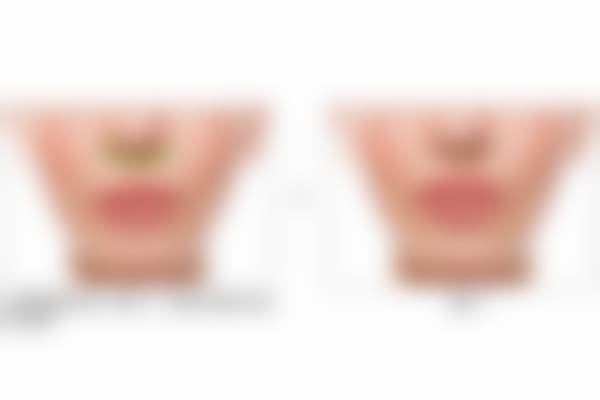 张兵医生预约挂号