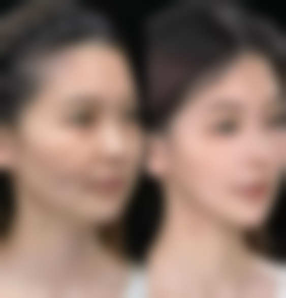 合肥崔劲松微创医疗美容门诊部预约挂号方式