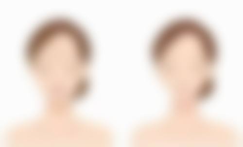 彭华伟医生技术优势