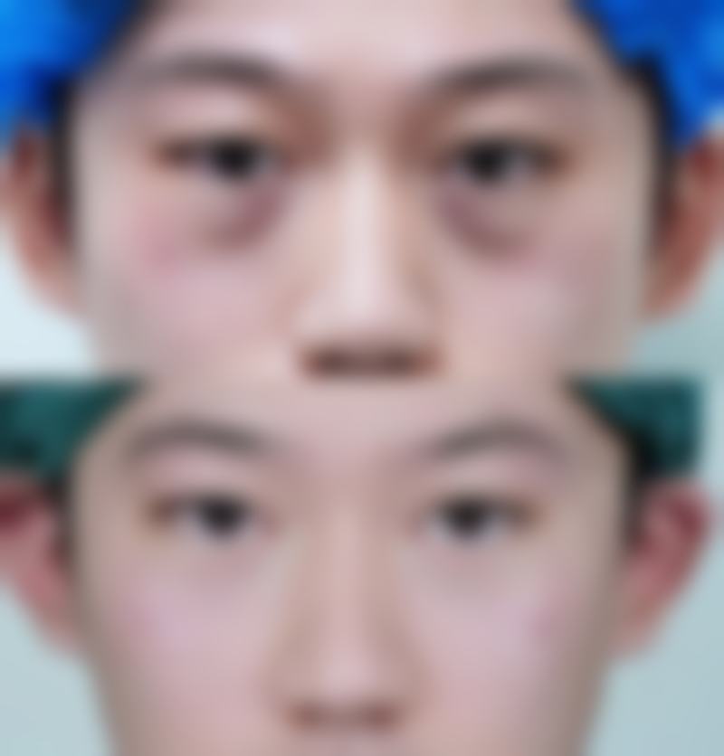 沈阳悦己医疗美容门诊部收费价格表