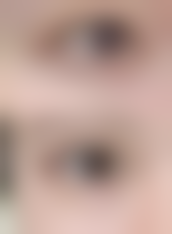 芜湖美汐医疗美容诊所收费价格表