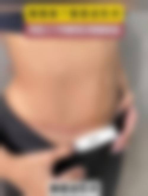 霍孟华医生项目收费价格