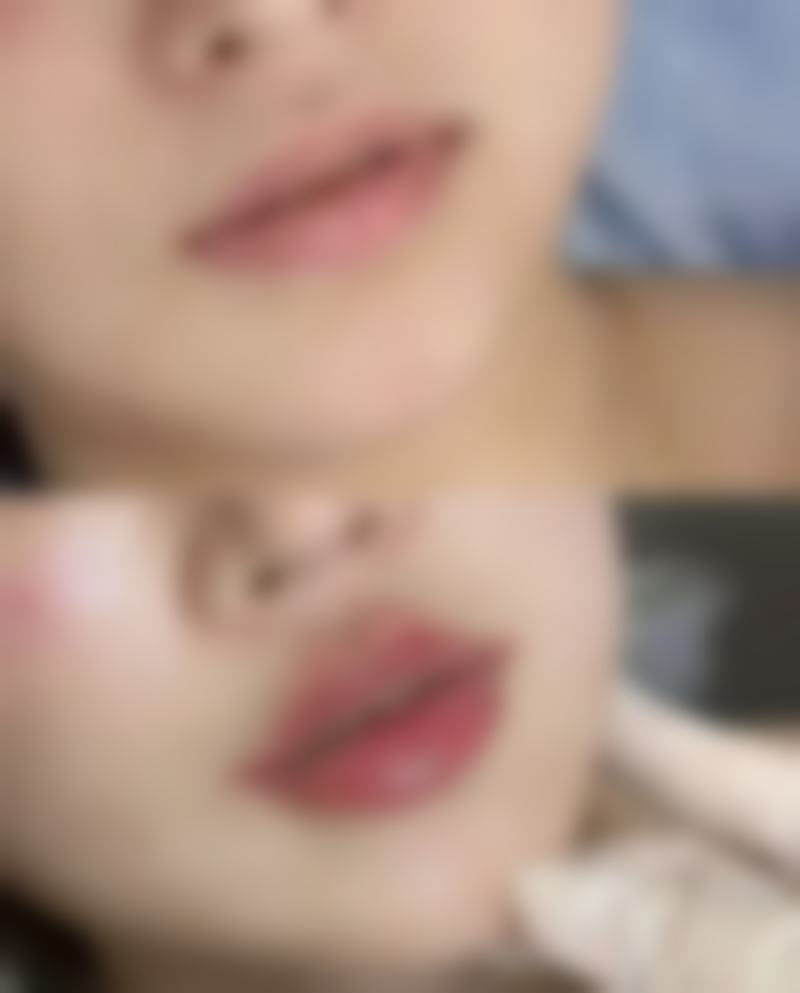 郑春玲医生口碑评价及反馈内容