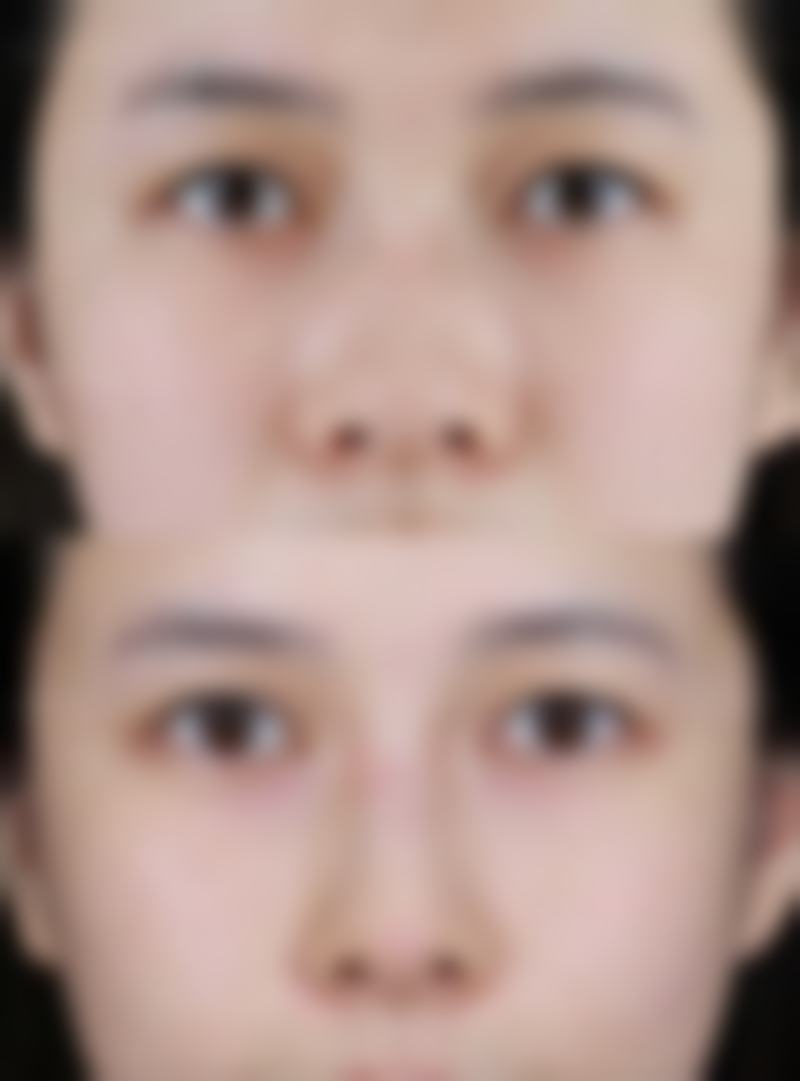 上海瑞东医院整形科收费价格表